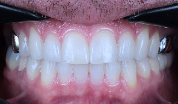 After -Dr Nina Shaffie