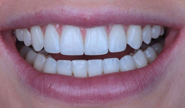 After -Dr Nina Shaffie