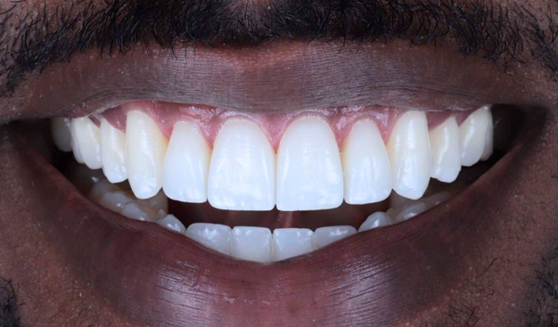 After -Dr Nina Shaffie