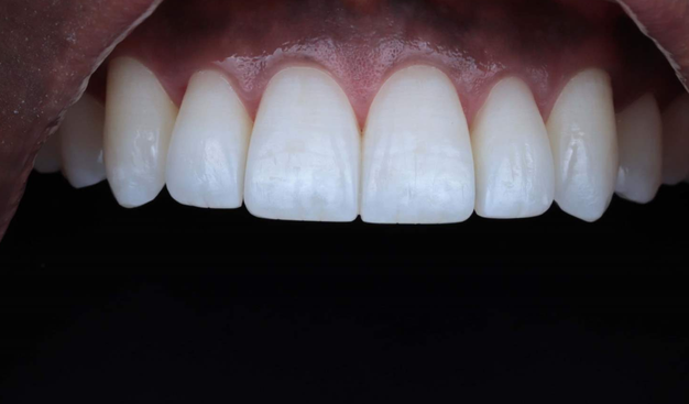 After -Dr Nina Shaffie