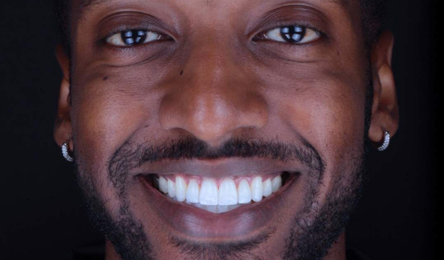 After -Dr Nina Shaffie