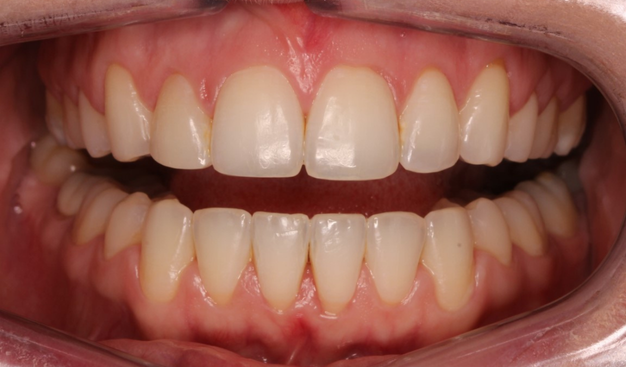 After -Dr Nina Shaffie