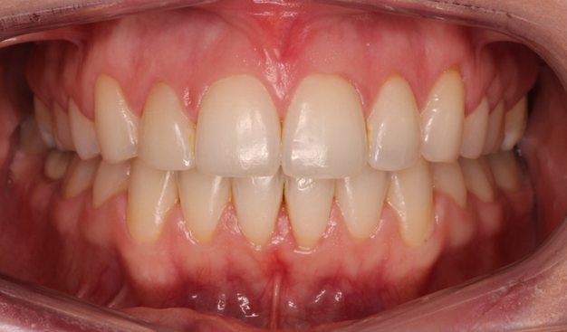 After -Dr Nina Shaffie