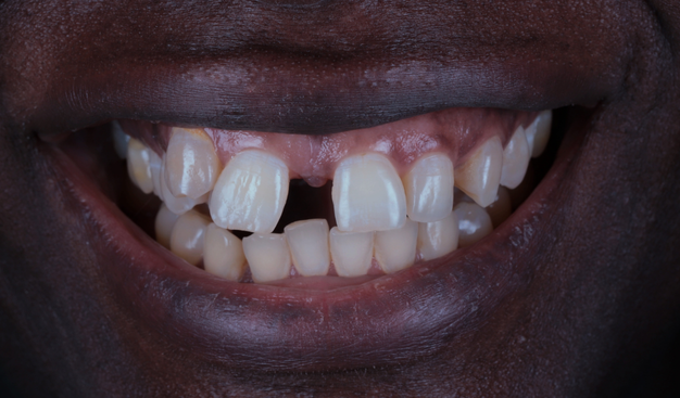 Before - Dr Nina Shaffie