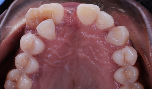 Before - Dr Nina Shaffie