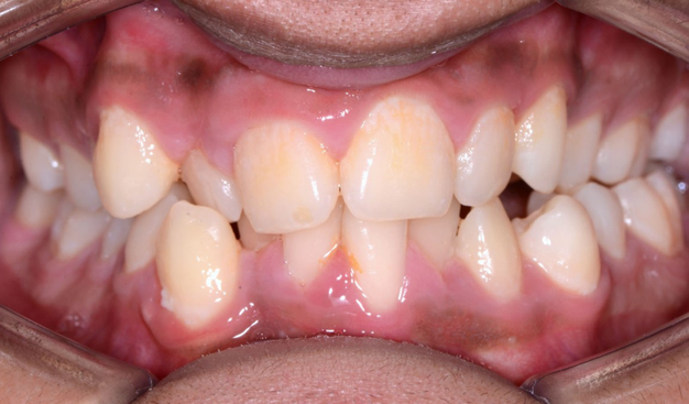 Before - Dr Nina Shaffie