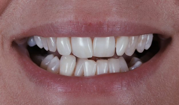 Before - Dr Nina Shaffie