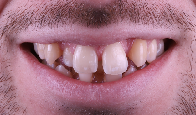 Before - Dr Nina Shaffie