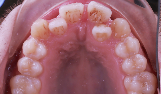 Before - Dr Nina Shaffie