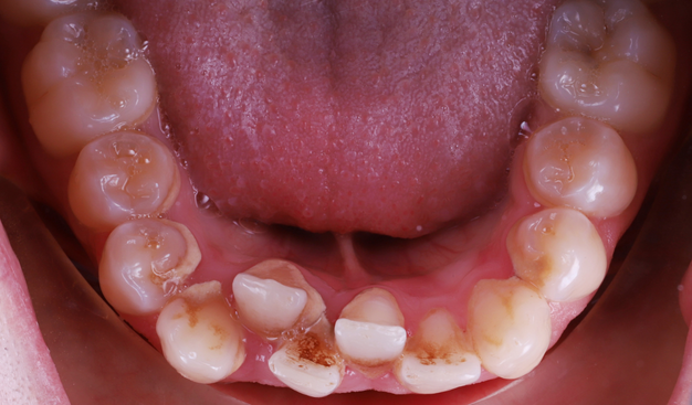 Before - Dr Nina Shaffie