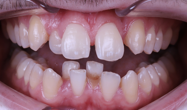 Before - Dr Nina Shaffie