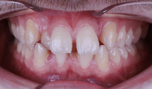 Before - Dr Nina Shaffie