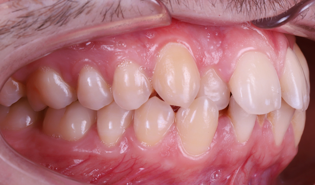 Before - Dr Nina Shaffie