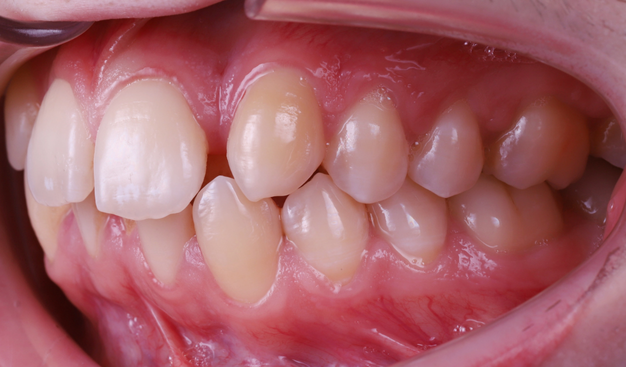 Before - Dr Nina Shaffie