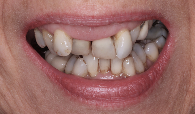 Before - Dr Nina Shaffie