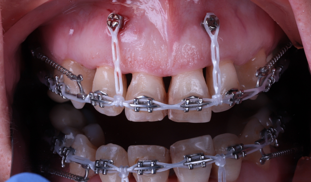 Before - Dr Nina Shaffie