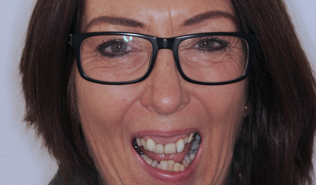 Before - Dr Nina Shaffie