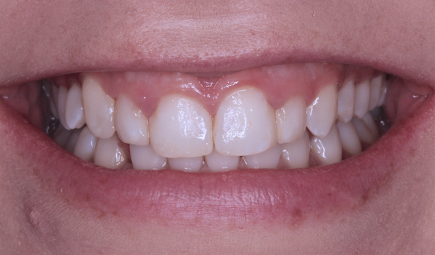 Before - Dr Nina Shaffie