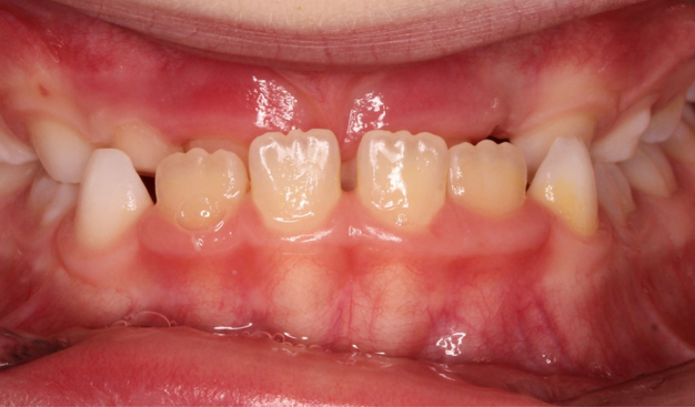 Before - Dr Nina Shaffie