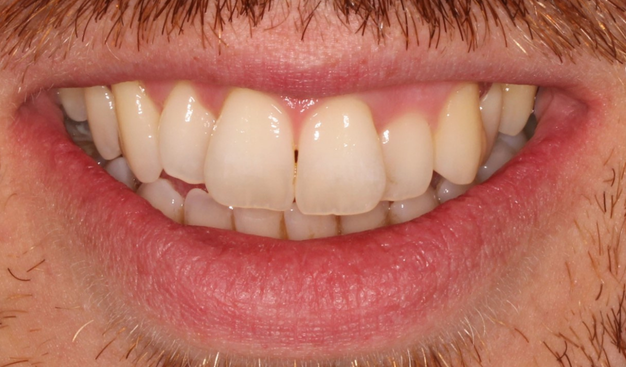 Before - Dr Nina Shaffie