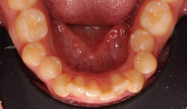 Before - Dr Nina Shaffie