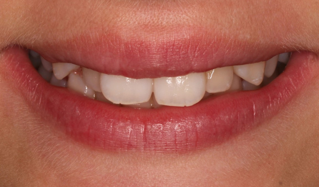 Before - Dr Nina Shaffie