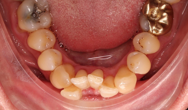 Before - Dr Nina Shaffie