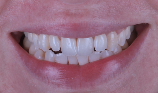 Before - Dr Nina Shaffie