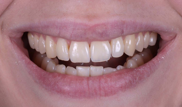 Before - Dr Nina Shaffie