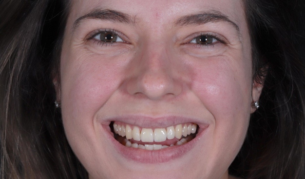 Before - Dr Nina Shaffie