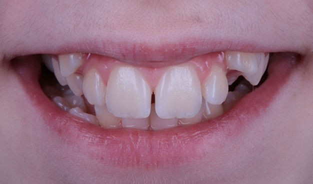 Before - Dr Nina Shaffie