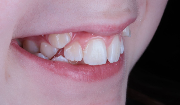 Before - Dr Nina Shaffie