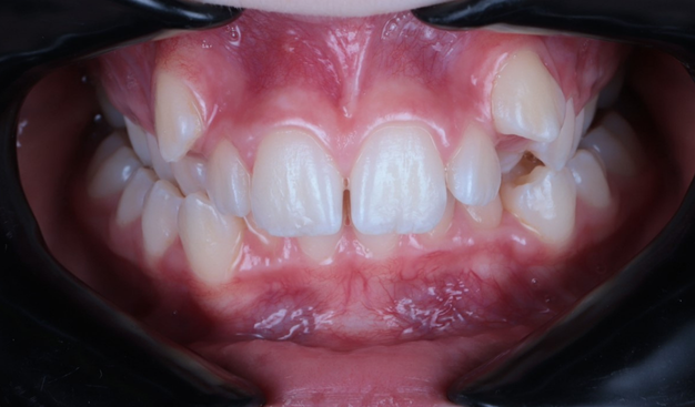 Before - Dr Nina Shaffie