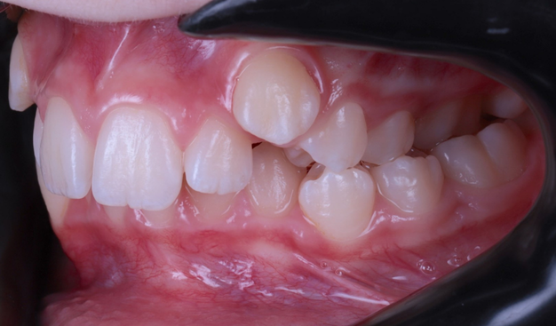 Before - Dr Nina Shaffie