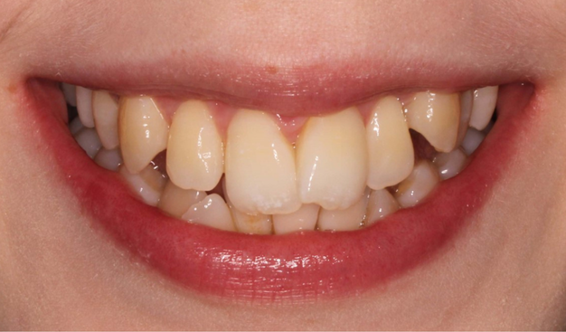 Before - Dr Nina Shaffie