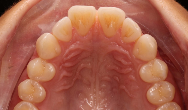 Before - Dr Nina Shaffie