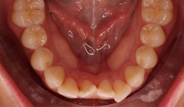 Before - Dr Nina Shaffie