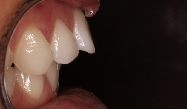 Before - Dr Nina Shaffie