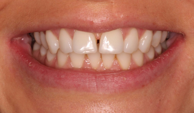 Before - Dr Nina Shaffie