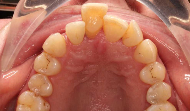 Before - Dr Nina Shaffie