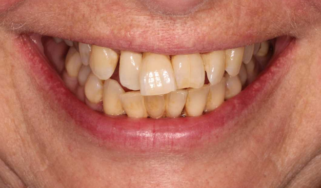 Before - Dr Nina Shaffie