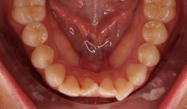 Before - Dr Nina Shaffie