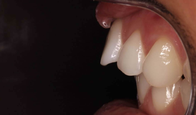 Before - Dr Nina Shaffie