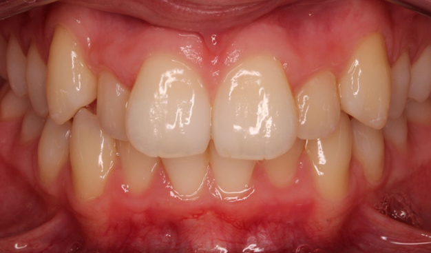 Before - Dr Nina Shaffie