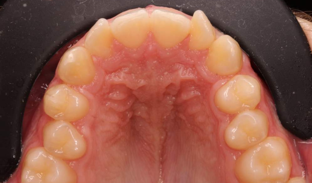 Before - Dr Nina Shaffie