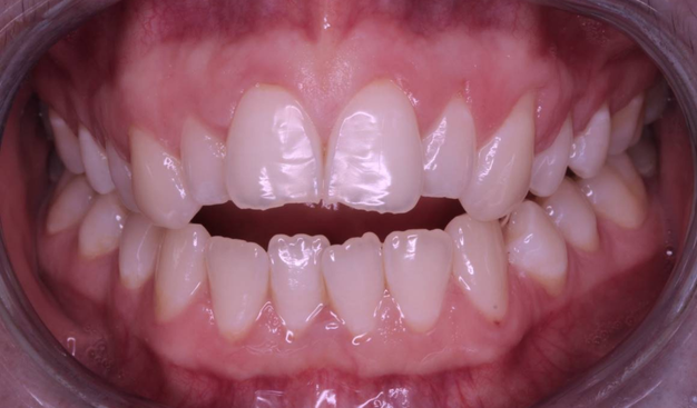 Before - Dr Nina Shaffie