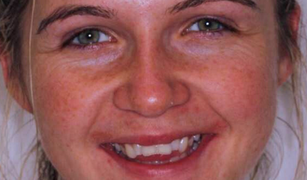 Before - Dr Nina Shaffie