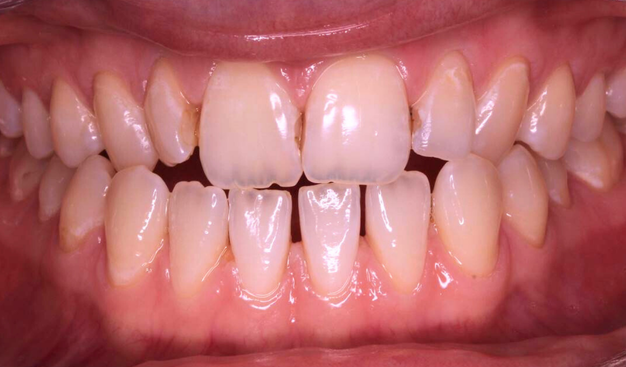 Before - Dr Nina Shaffie