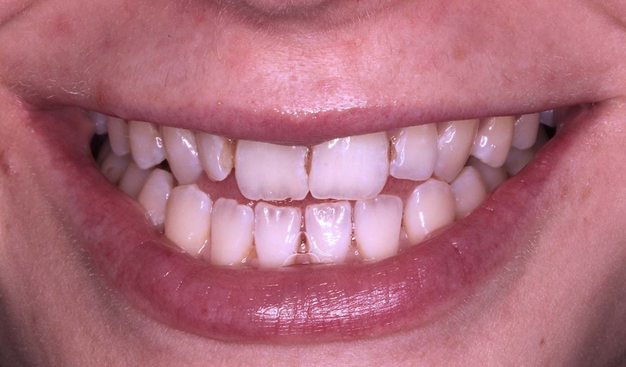 Before - Dr Nina Shaffie