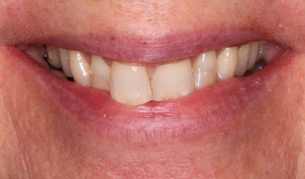 Before - Dr Nina Shaffie